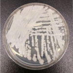 Strain of C. auris cultured in a petri dish at CDC. Credit Shawn Lockhart, CDC. Taken from foxnews.com