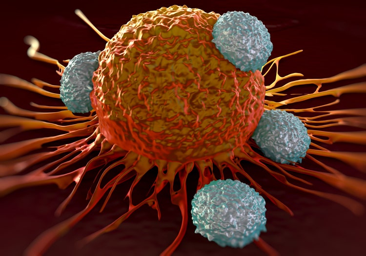 Immune cells attacking a cancer cell.