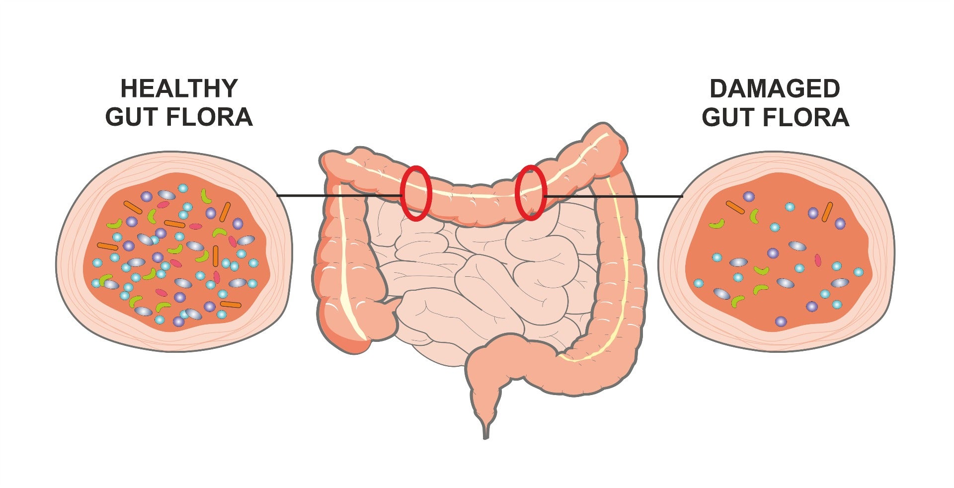 Microbiome