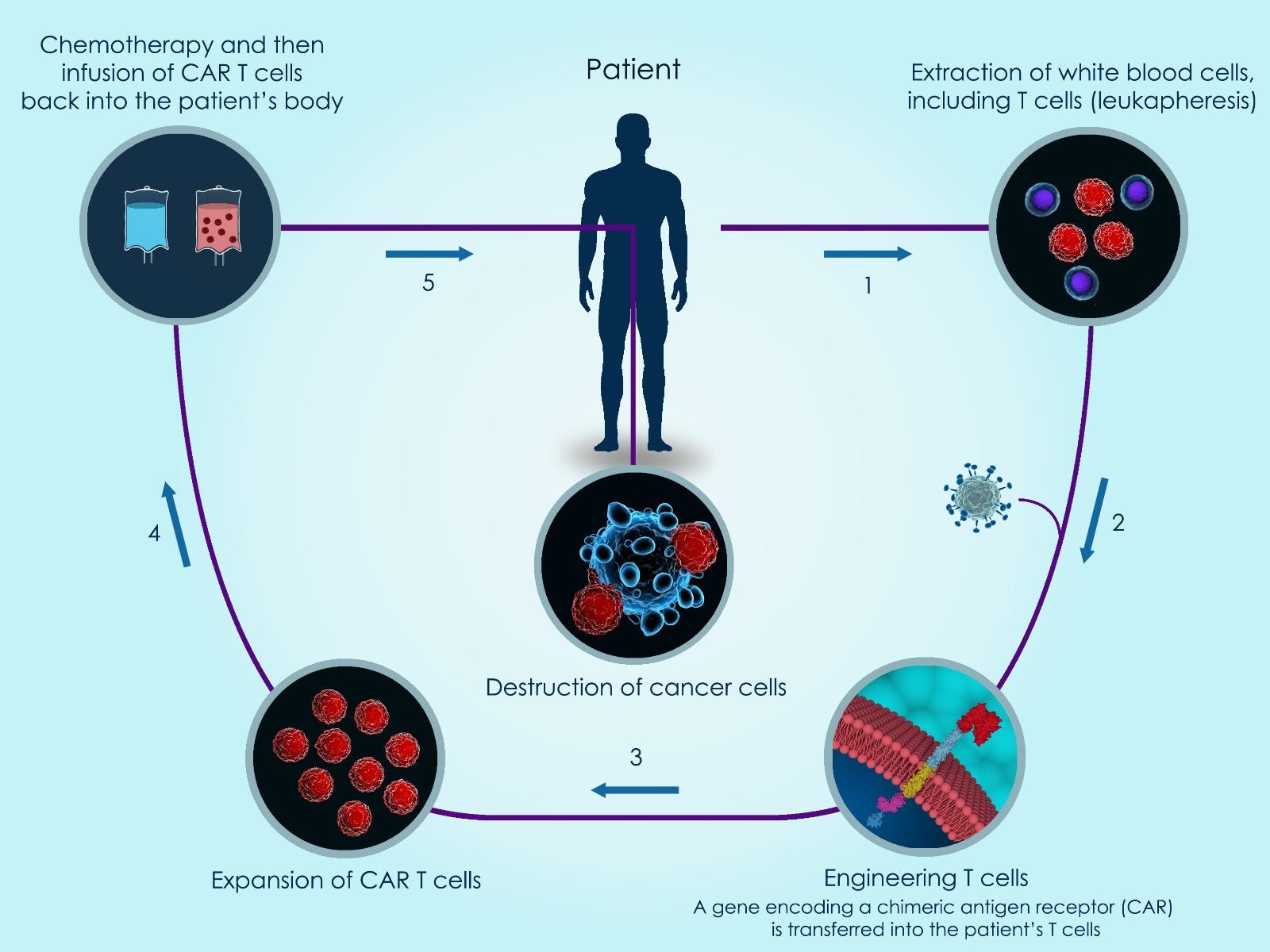 CAR T Cells Into Patient Body