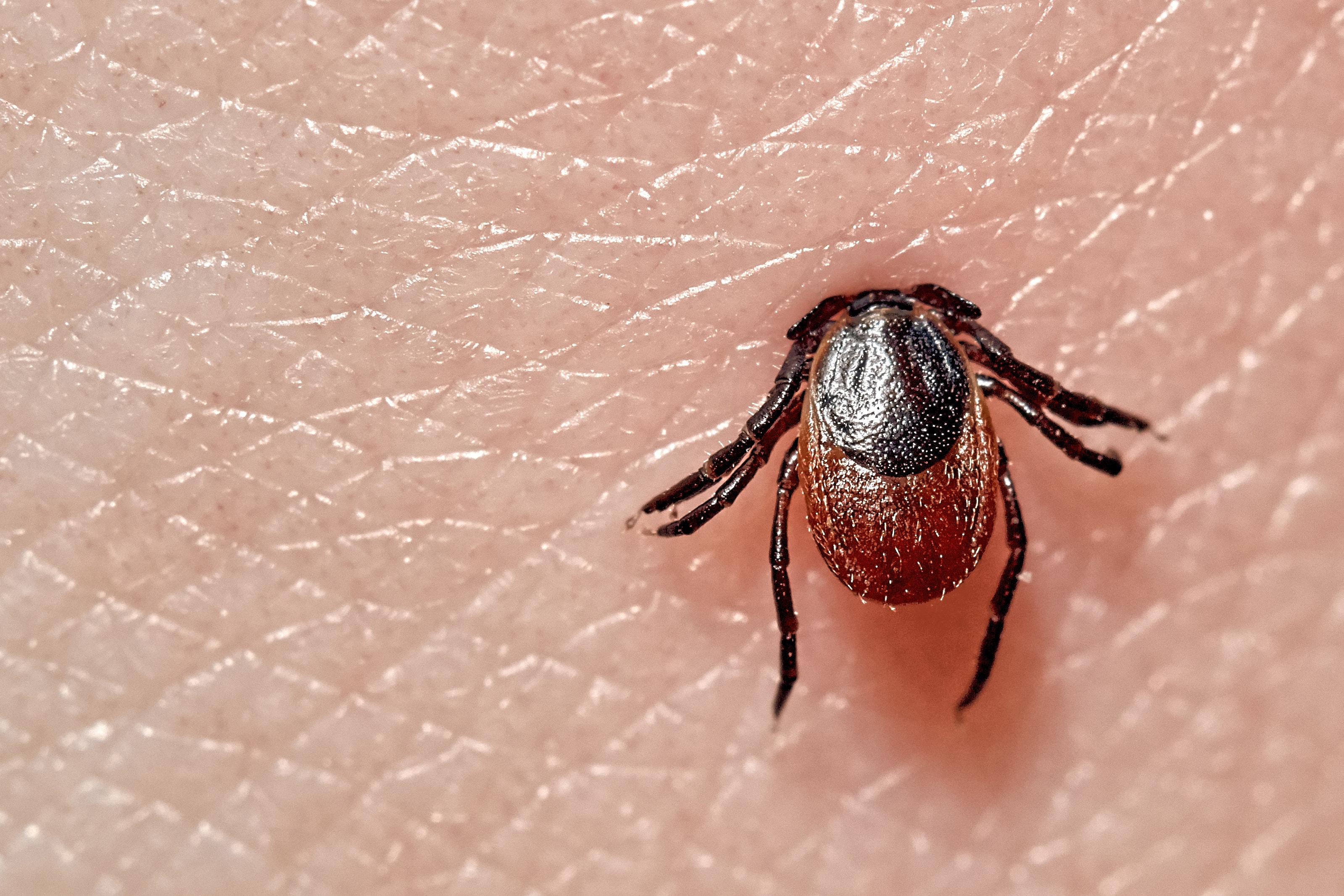 Tick Macro photo on human skin