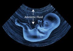 Amniotic fluid surrounds a developing fetus